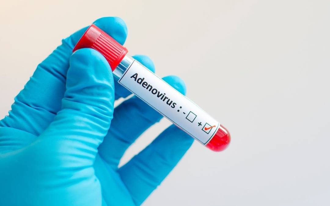 Người dân không quá hoang mang về dịch bệnh do Adenovirus - Ảnh 1.