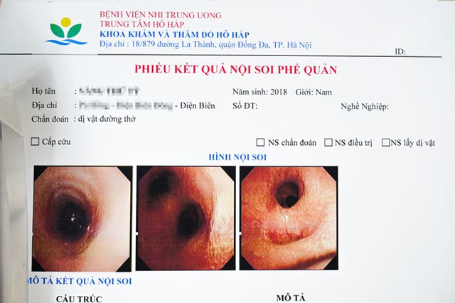 Bé trai 4 tuổi bị đỉa bám trong khí quản suốt cả tháng sau khi đi tắm suối - Ảnh 2.