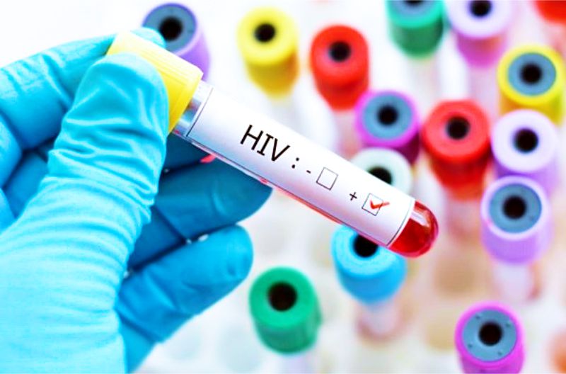 Phát hiện đột phá mở đường cho khả năng chữa khỏi HIV  - Ảnh 1.