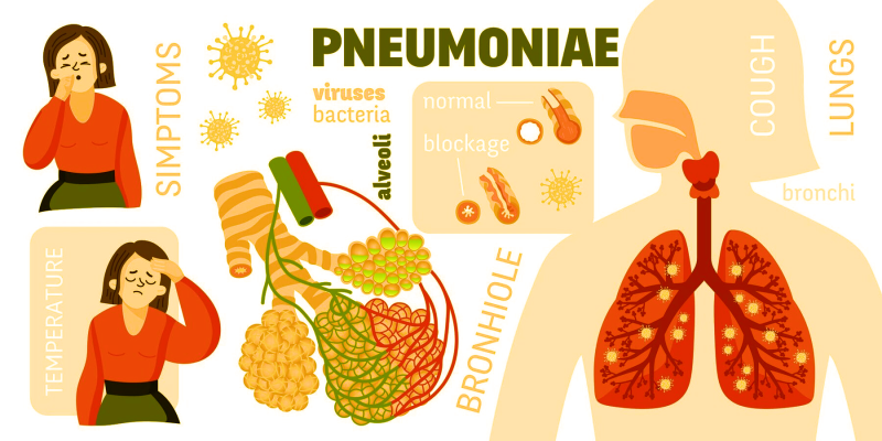 Cảnh báo viêm phổi ở trẻ em do vi khuẩn M.pneumoniae gây biến chứng  - Ảnh 1.
