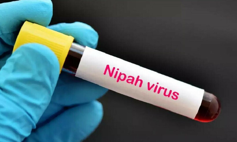 Khuyến cáo của Bộ Y tế về phòng dịch bệnh do virus Nipah- Ảnh 1. Khuyến cáo của Bộ Y tế về phòng dịch bệnh do virus Nipah- Ảnh 1.