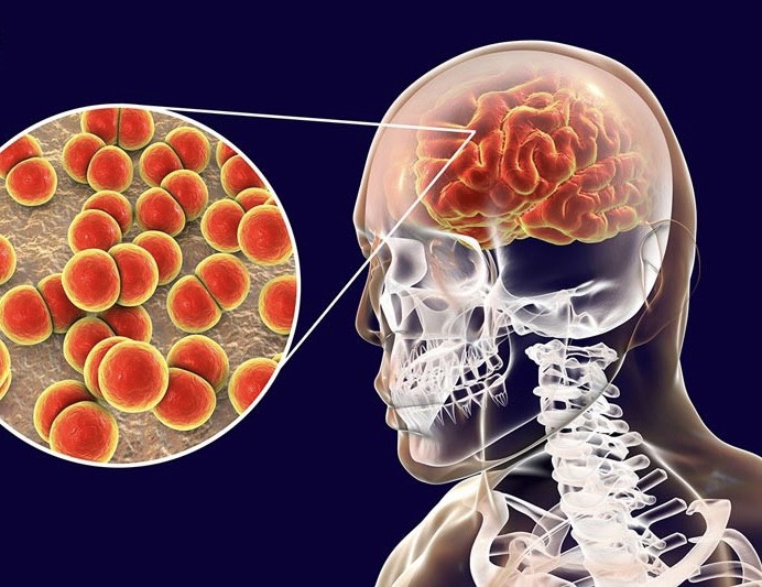 C&agrave; Mau khẩn cấp ứng ph&oacute; dịch n&atilde;o m&ocirc; cầu sau khi c&oacute; th&ecirc;m 2 ca tử vong - Ảnh 4.