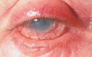 T&aacute;i diễn thủ đoạn trộn thuốc giảm đau v&agrave;o thuốc Đ&ocirc;ng y lừa b&aacute;n, 2 đối tượng bị khởi tố - Ảnh 6.
