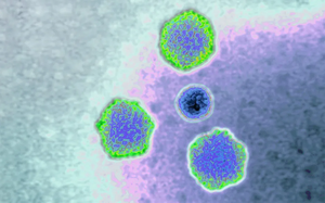 Gia tăng các ca bệnh do virus Adeno ở trẻ em: Virus Adeno là gì và cách phòng bệnh?