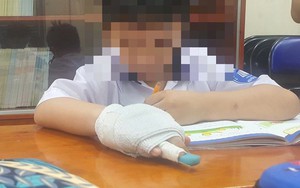 Vụ học sinh bị gãy ngón tay: Xem xét kỷ luật theo quy định, không bao che