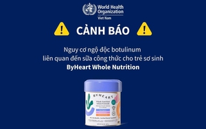 Các biện pháp giảm tác động của ô nhiễm không khí - Ảnh 4.