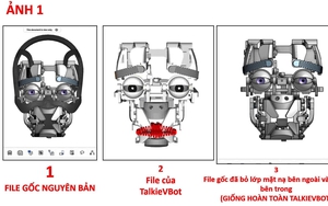 Bước tiến mới trong điều trị động kinh bằng robot định vị - Ảnh 1.