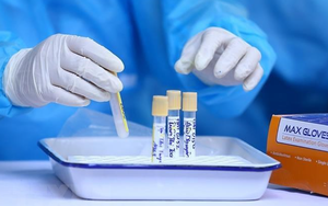 Biến thể phụ BA.4 và BA.5 gây ra gần 13% số ca mắc mới COVID-19 tại Mỹ trong tuần qua - Ảnh 2.