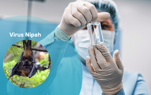 Virus Nipah bật chế độ ph&ograve;ng vệ của c&aacute;c quốc gia Nam &Aacute; - Ảnh 4.