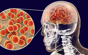Sau ổ dịch n&atilde;o m&ocirc; cầu: Nh&acirc;n rộng m&ocirc; h&igrave;nh đội chăm s&oacute;c sức khỏe li&ecirc;n tục đến 100% Trạm Y tế x&atilde;, phường  - Ảnh 5.