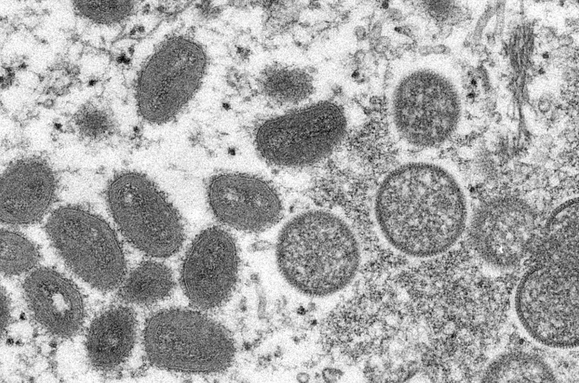 Virus gây bệnh đậu mùa khỉ tiếp tục lây lan - Ảnh 1.