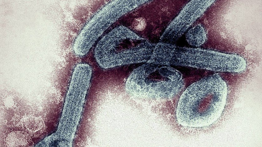 WHO cảnh báo loại virus có thể gây chết người đến 90% - Ảnh 1.