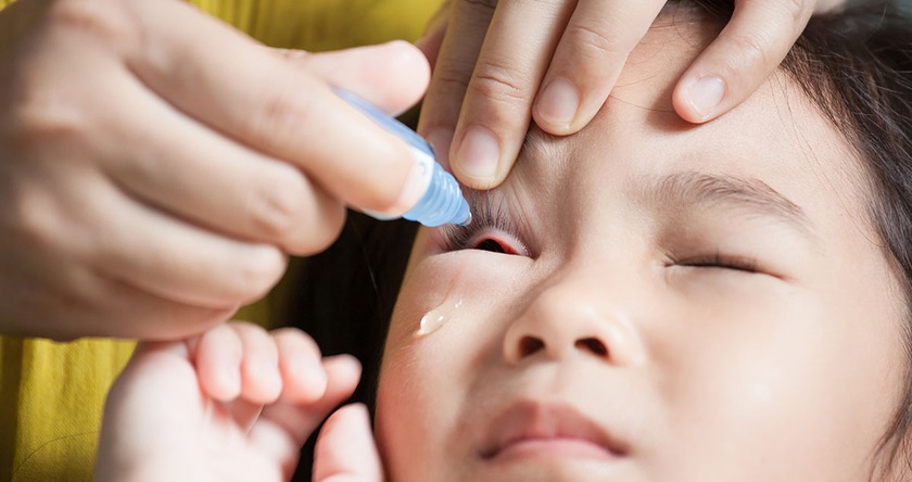 Bệnh đau mắt đỏ lây lan nhanh trong trường học, lưu ý khi chăm sóc trẻ bị bệnh - Ảnh 3.