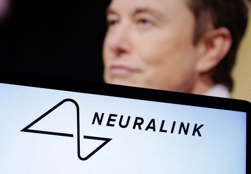 Neuralink của tỷ phú Elon Musk bắt đầu thử nghiệm cấy ghép chip vào não người - Ảnh 1.