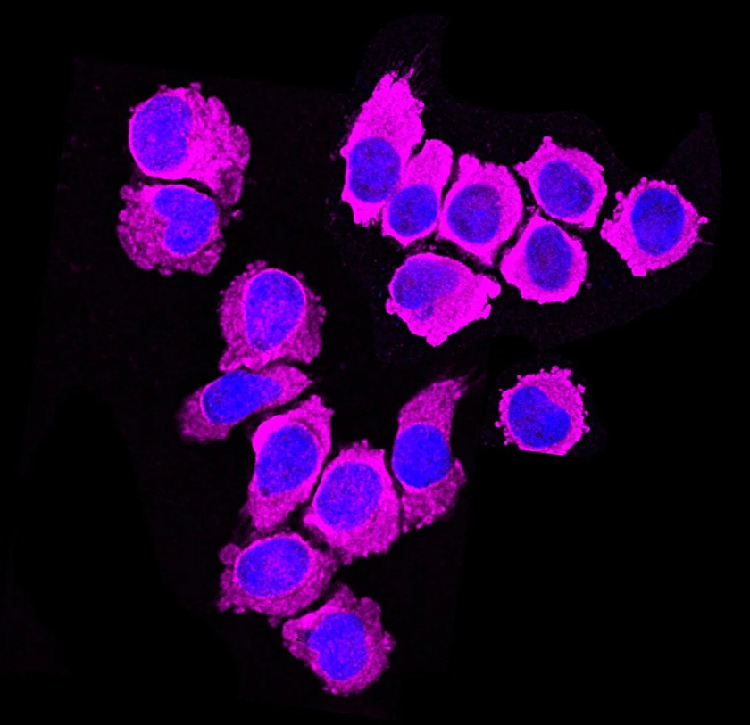 Phát hiện một loại tế bào miễn dịch có thể tiêu diệt các khối u ung thư- Ảnh 1.