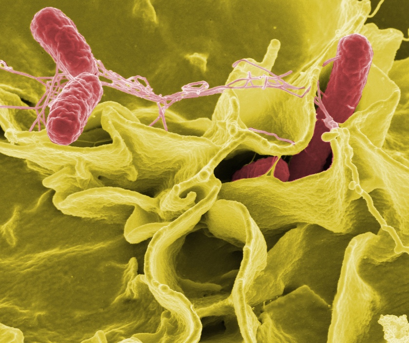 3 loại vi khuẩn chính gây ra vụ ngộ độc hàng loạt sau ăn cơm gà ở Nha Trang- Ảnh 2.