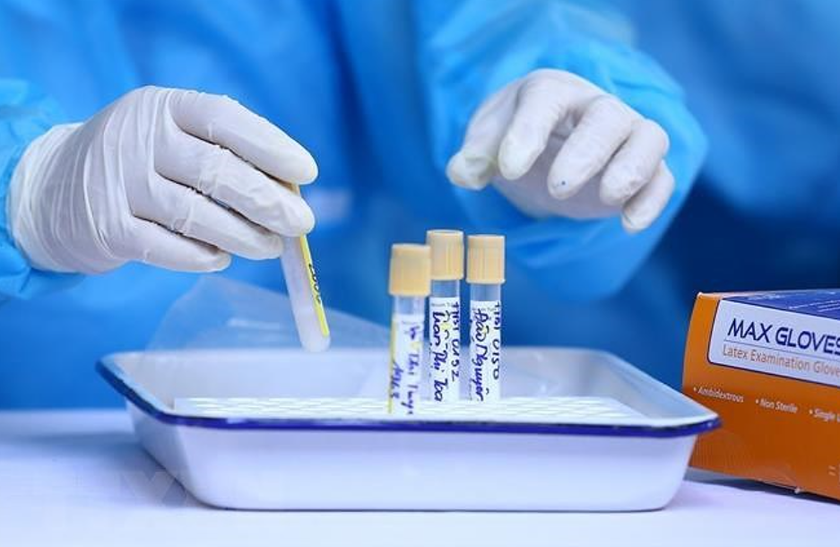 WHO cảnh báo về biến thể COVID-19 NB.1.8.1- Ảnh 1. WHO cảnh báo về biến thể COVID-19 NB.1.8.1- Ảnh 1.