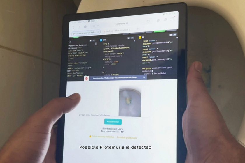 Bí mật ẩn giấu trong viên tẩy bồn cầu Urify: Không chỉ khử trùng, còn chẩn đoán bệnh thận - Ảnh 4.