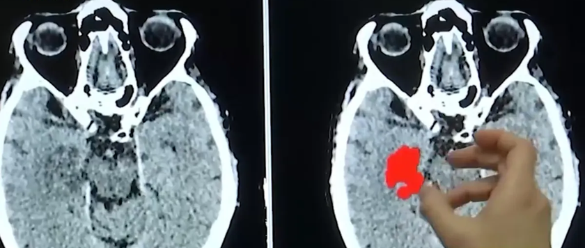 Tại sao c&oacute; hạt vi nhựa trong cơ thể người? - Ảnh 3.