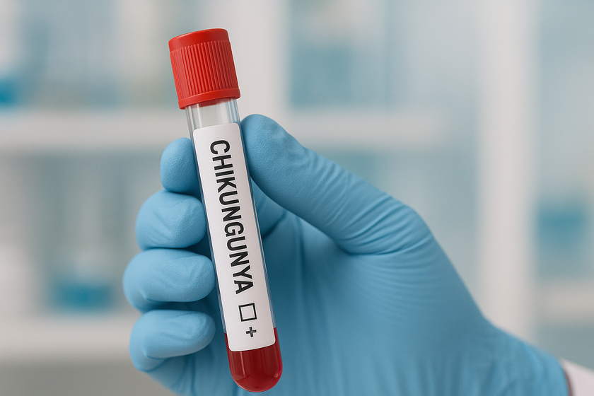 Một số khuyến cáo của Bộ Y tế về phòng, chống dịch bệnh Chikungunya- Ảnh 1. Một số khuyến cáo của Bộ Y tế về phòng, chống dịch bệnh Chikungunya- Ảnh 1.