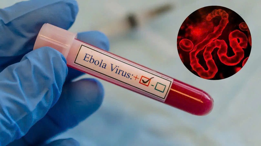 Hướng dẫn của Bộ Y tế về bệnh do vi r&uacute;t Ebola - Ảnh 1.