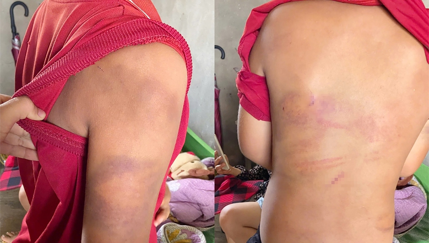 C&ocirc;ng an Nghệ An l&agrave;m việc với người bố đ&aacute;nh đập con trai bầm t&iacute;m - Ảnh 2.
