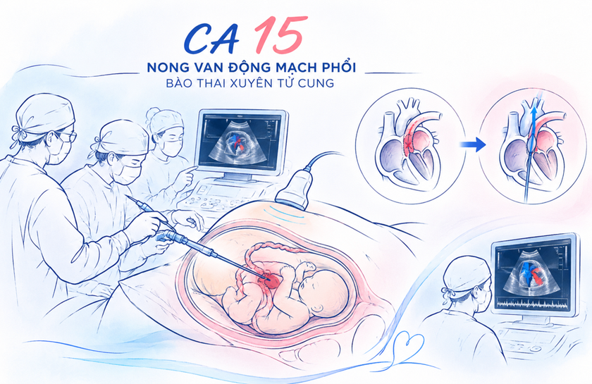 Thành phố Hồ Chí Minh thông tim bào thai ca thứ 15 thành công - Ảnh 1.