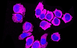 Phát hiện một loại tế bào miễn dịch có thể tiêu diệt các khối u ung thư
