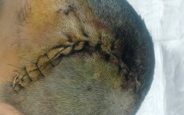 Phẫu thuật sọ não cứu học sinh ở Nghệ An bị đánh hội đồng