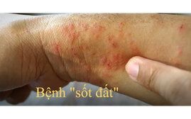 Bệnh "sốt đất" ở Thái Lan - đi du lịch Thái Lan nên lưu ý gì?