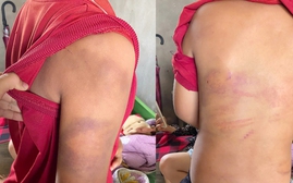 Công an Nghệ An làm việc với người bố đánh đập con trai bầm tím