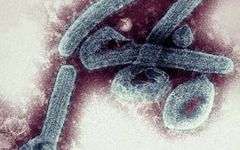 WHO cảnh báo loại virus có thể gây chết người đến 90%