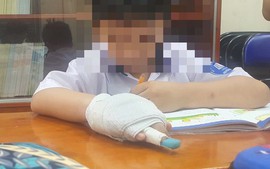 Vụ học sinh bị gãy ngón tay: Xem xét kỷ luật theo quy định, không bao che