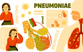 Cảnh báo viêm phổi ở trẻ em do vi khuẩn M.pneumoniae gây biến chứng