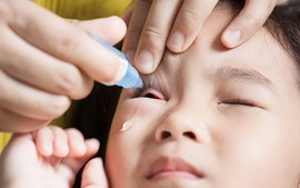 Bệnh đau mắt đỏ lây lan nhanh trong trường học, lưu ý khi chăm sóc trẻ bị bệnh