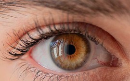 Tránh lây lan dịch đau mắt đỏ trong cộng đồng
