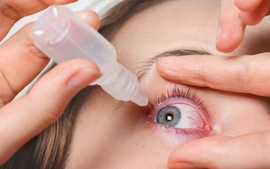 Lưu ý quan trọng khi sử dụng thuốc nhỏ mắt trị bệnh đau mắt đỏ