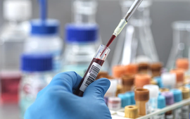 Nghiên cứu xét nghiệm máu phát hiện ung thư sớm của Tiến sĩ người Việt được ghi nhận tại Mỹ