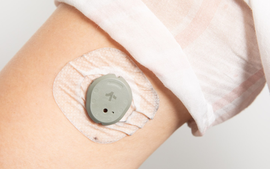 CGM: Thiết bị đeo tay giúp ích cho cuộc chiến chống lại bệnh đái tháo đường