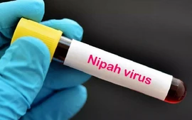 Khuyến cáo của Bộ Y tế về phòng dịch bệnh do virus Nipah