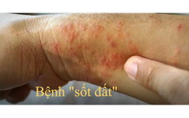 Bệnh "sốt đất" ở Thái Lan - đi du lịch Thái Lan nên lưu ý gì?