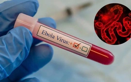Hướng dẫn mới của Bộ Y tế về bệnh do vi rút Ebola