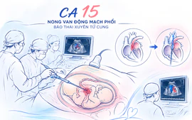 Thành phố Hồ Chí Minh thông tim bào thai ca thứ 15 thành công