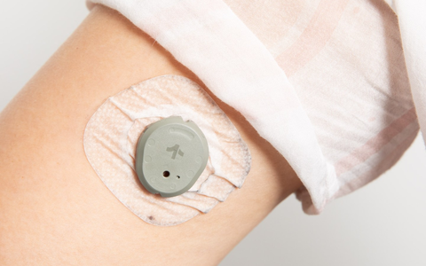 CGM: Thiết bị đeo tay giúp ích cho cuộc chiến chống lại bệnh đái tháo đường