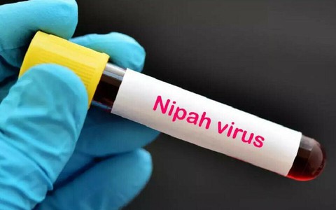 Khuyến cáo của Bộ Y tế về phòng dịch bệnh do virus Nipah