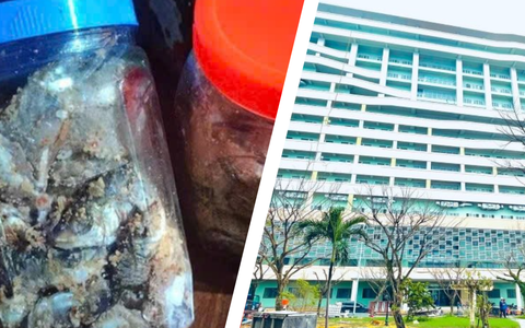 Botulinum: Độc tố chết người trong bữa ăn quen thuộc