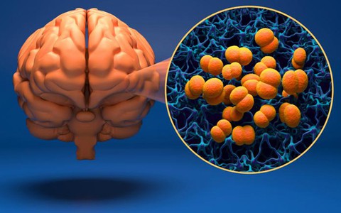 Nhận biết căn bệnh não mô cầu gây tử vong