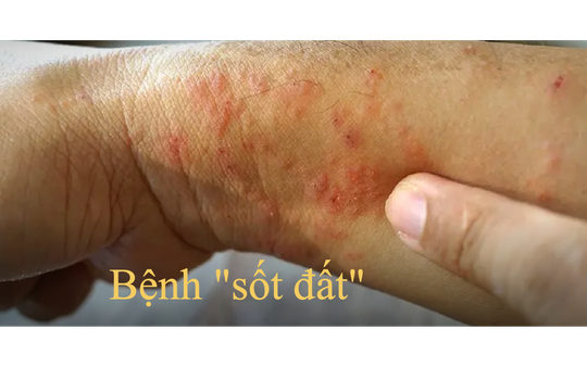 Bệnh "sốt đất" ở Thái Lan - đi du lịch Thái Lan nên lưu ý gì?